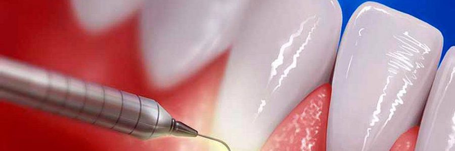 9b3faa2cdfbb661605dc4c97eac708d4