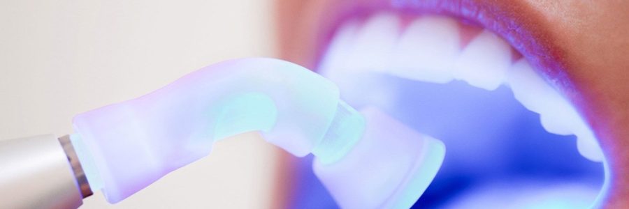 Отбеливание зубов в Калуге
