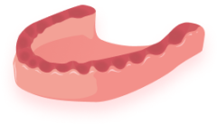 нет зубов имплантация