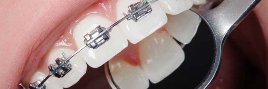 ортодонтия