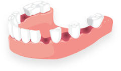 почти нет зубов